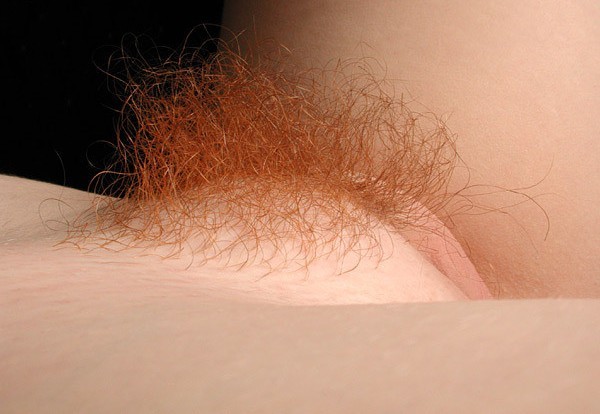 Fiery bush; Hairy Red Head 